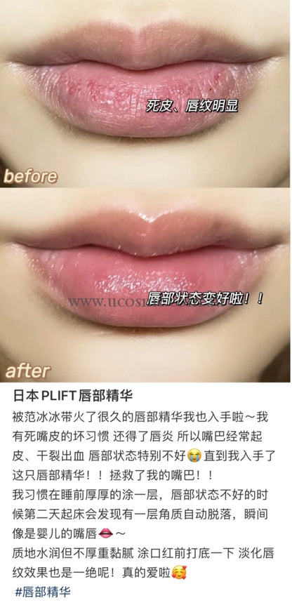 Plift6Ml